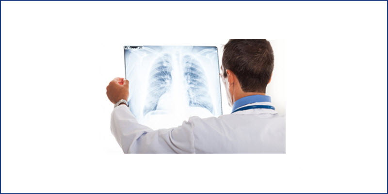 Pulmonary Rehabilitation