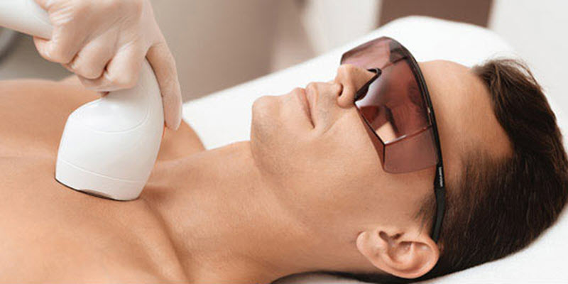 Men’s Laser Hair Removal