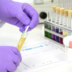 Drug Screening Services