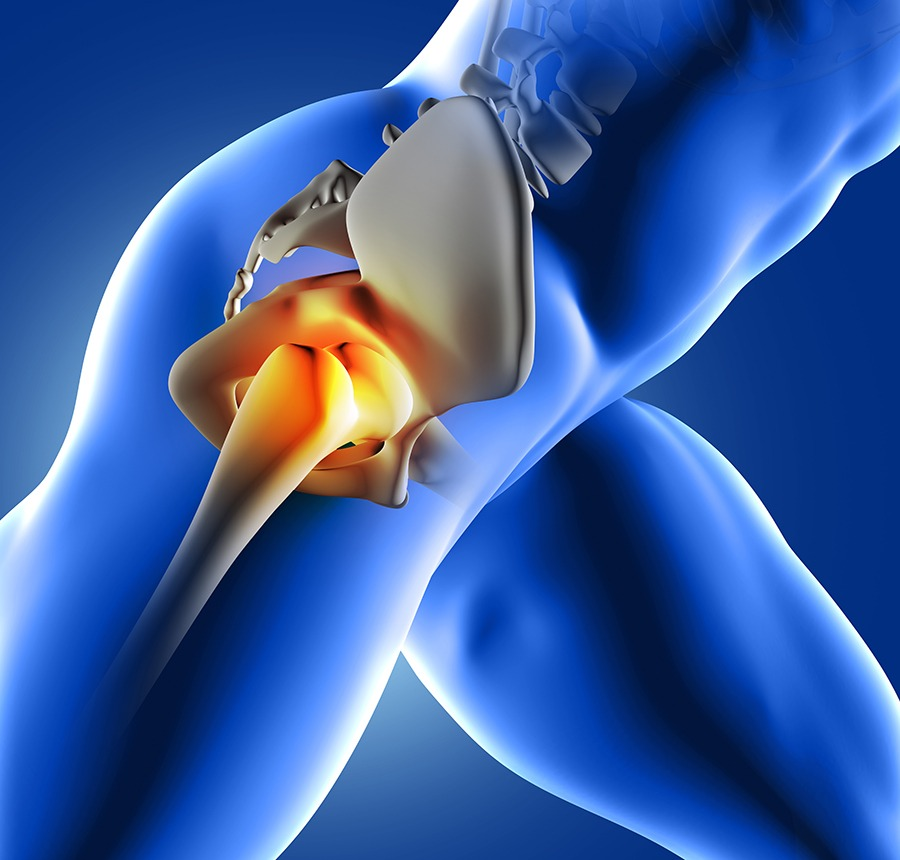 Orthopedic Hip Surgery