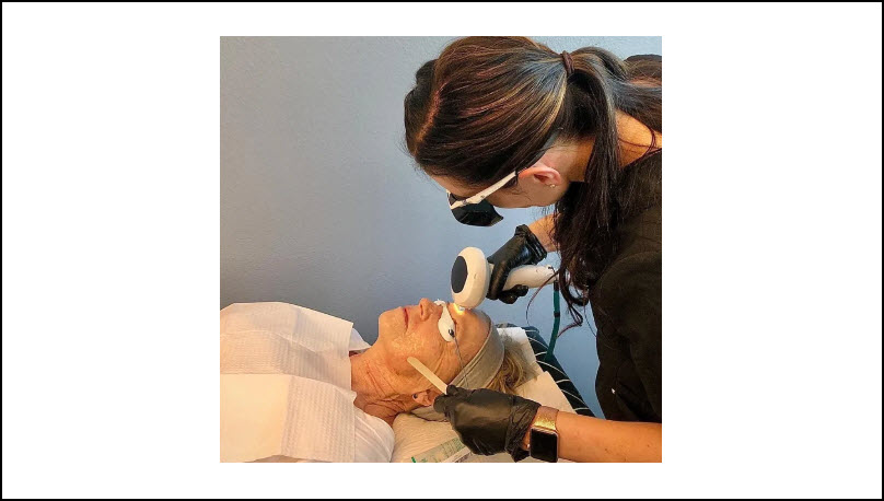 Lumecca IPL Photo Facial