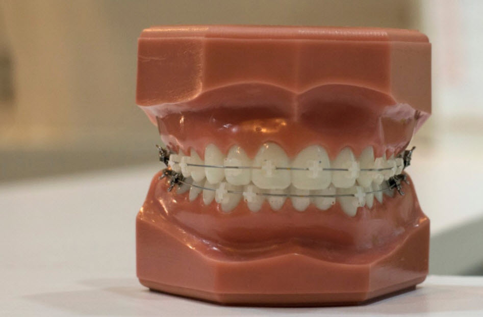 Dentures & Extractions