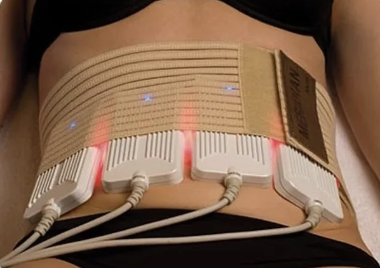 Laser Lipolysis