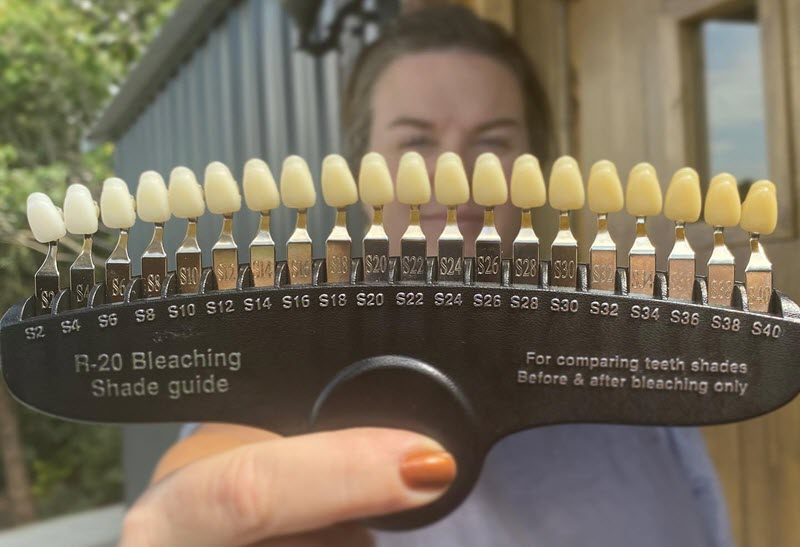 Teeth Whitening