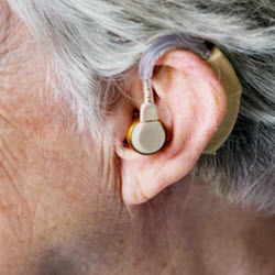 Hearing Aid Fittings and Servicing