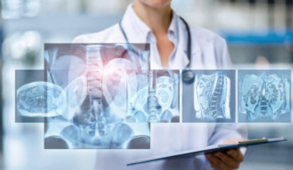 Computed Tomography