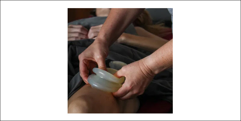 Cupping Massage