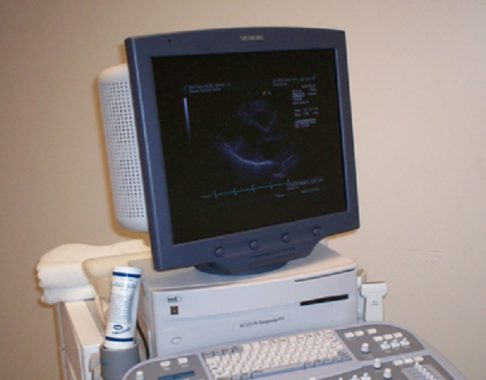 Diagnostic Medical Sonography