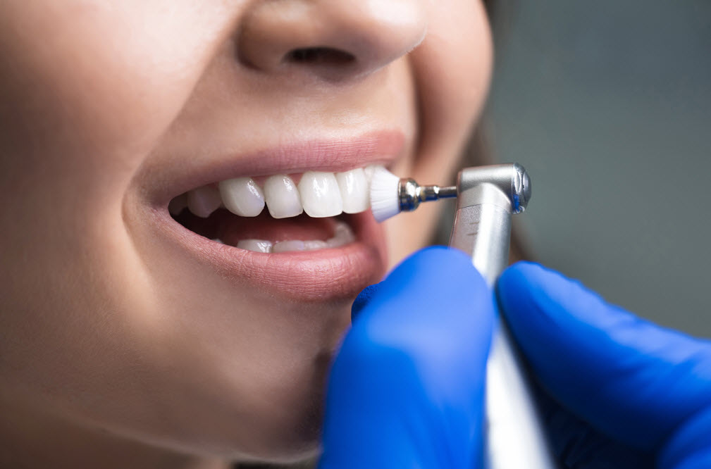 Dental Cleanings and Hygiene