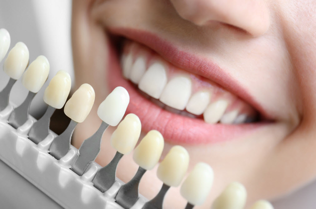Cosmetic Dentistry