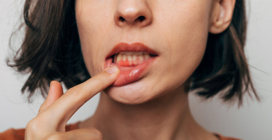 Periodontal Care