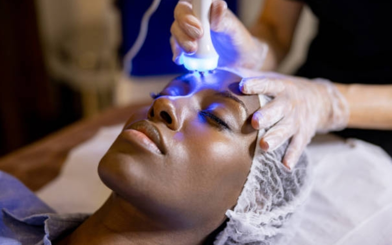 Microneedling