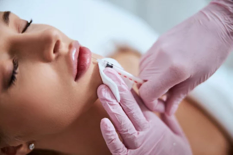 Dermal Filler