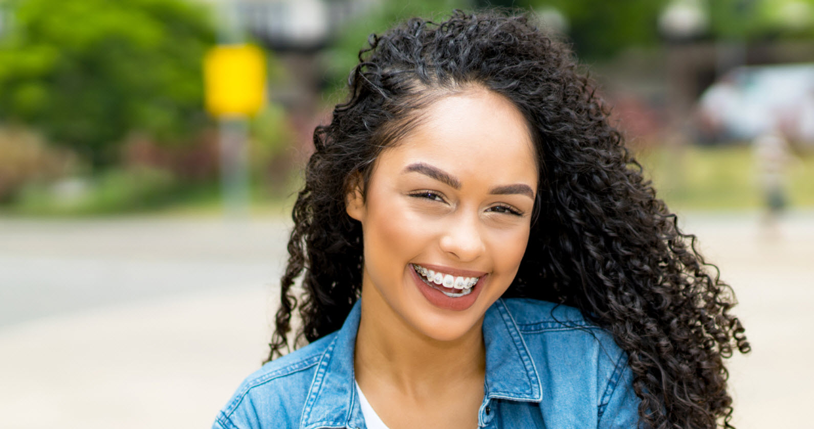 Braces Treatment