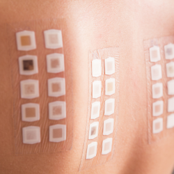  Patch Testing