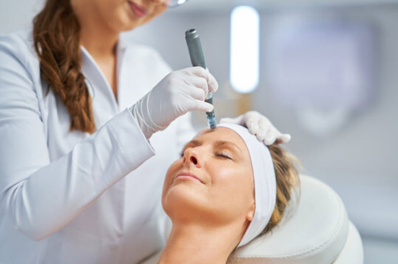 SkinPen® Microneedling for face and neck