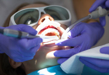 Laser Gum Surgery