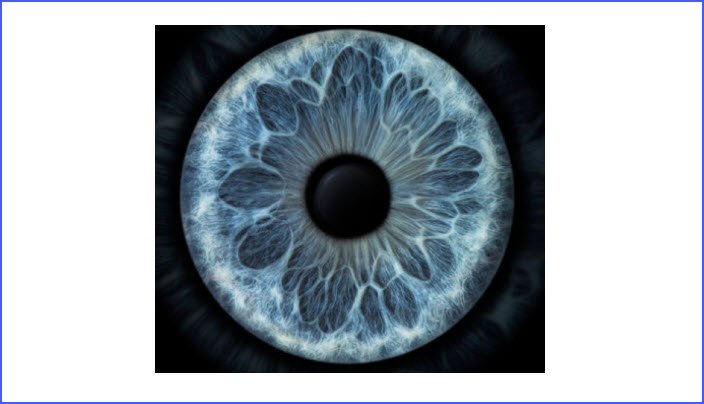 Catalys Laser Cataract Surgery