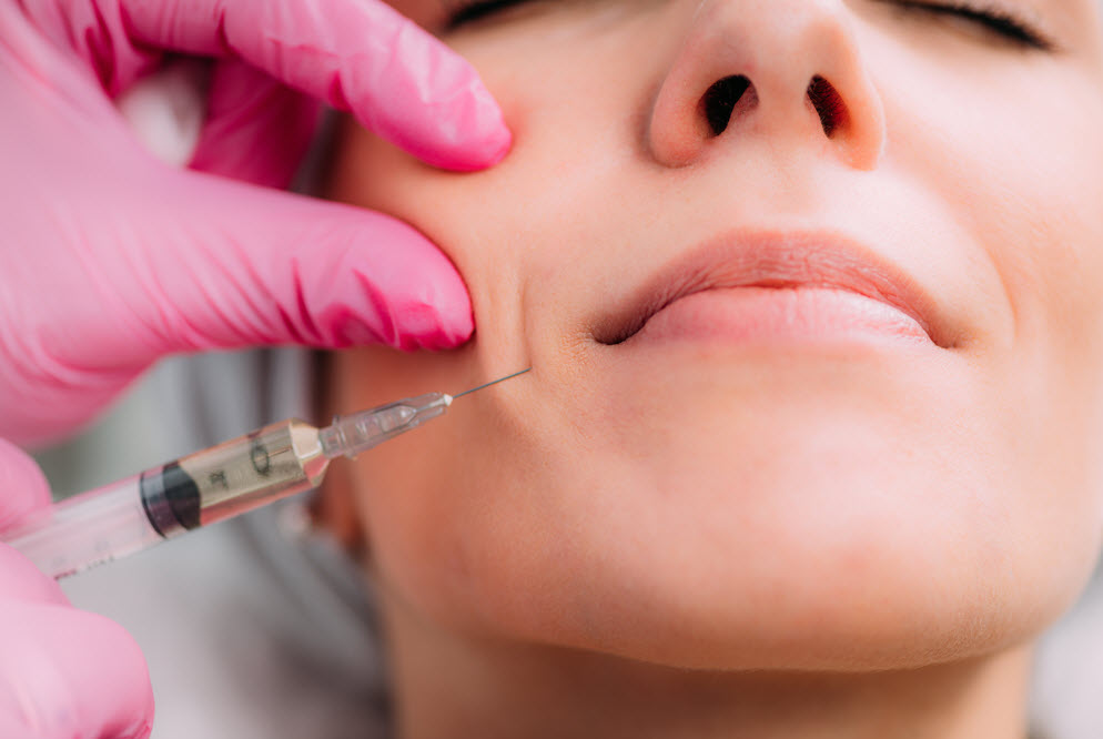 Dermal Filler