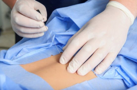 Spine Orthopedic Surgeons