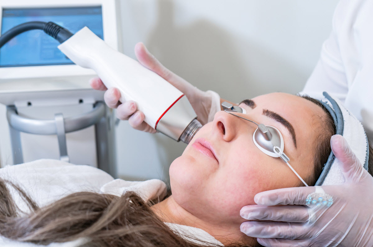 RF Micro Needling