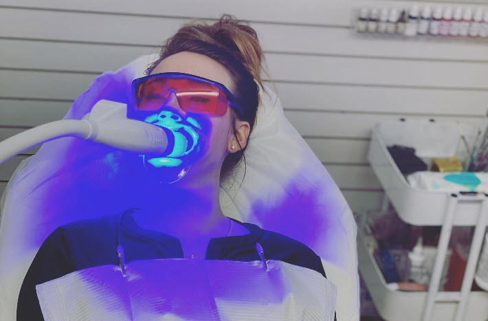 Teeth Whitening