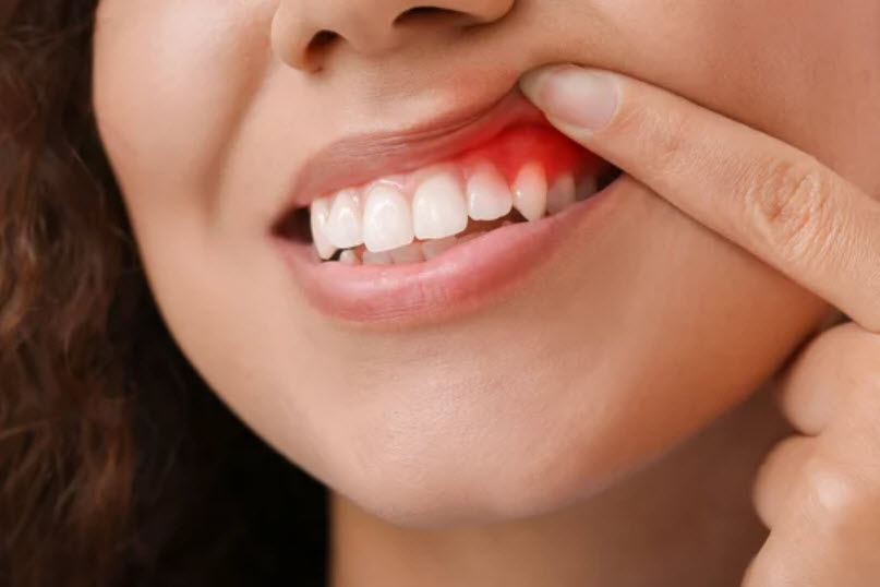 Periodontal (Gum) Care