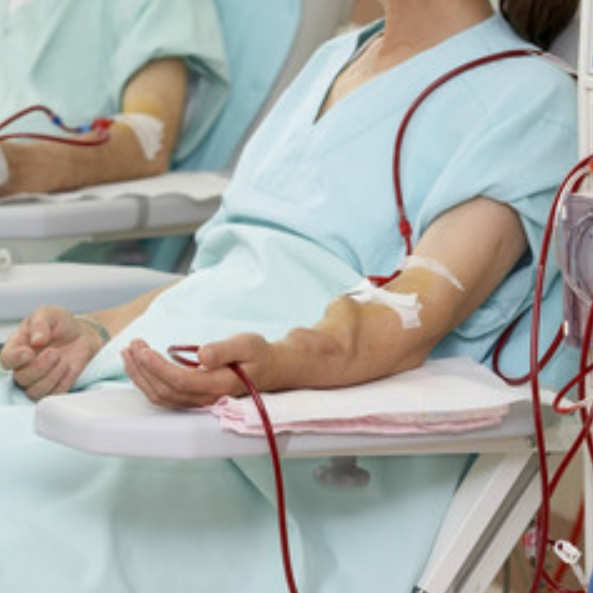 Regular Hemodialysis