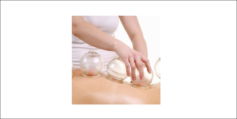 Cupping