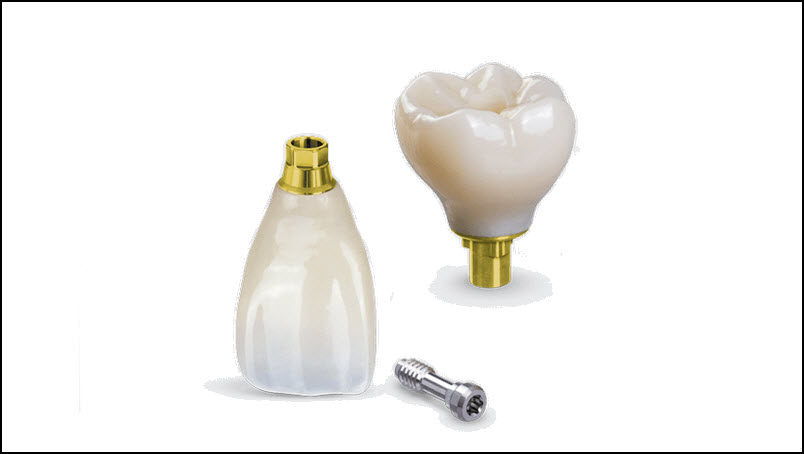 Implants