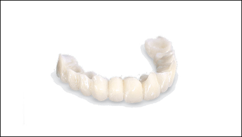 Provisionals