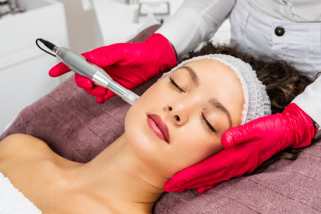 Microneedling