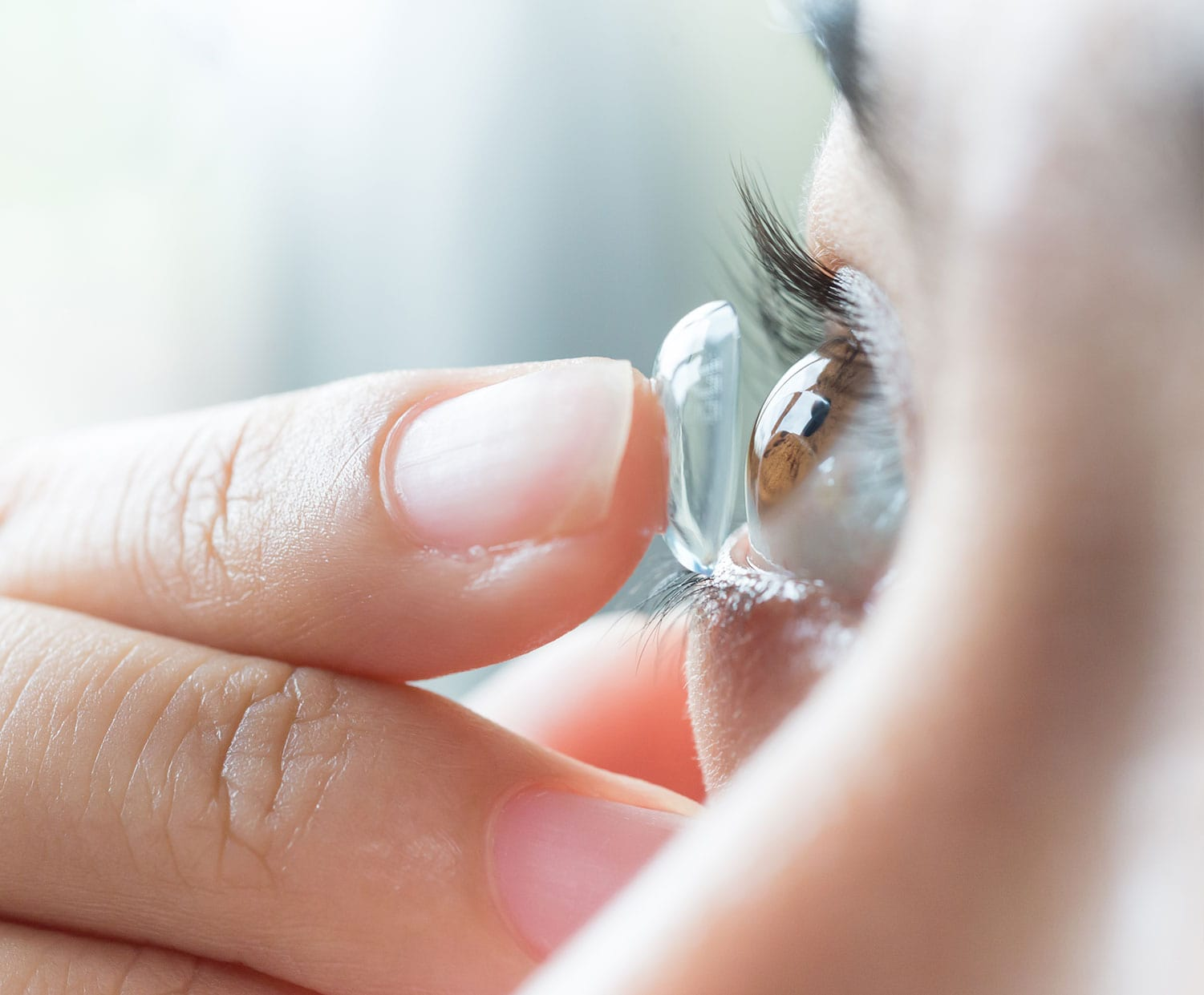 Scleral Lenses