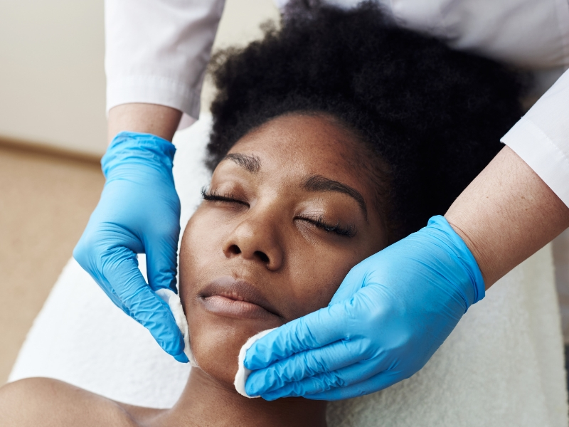 Acne Treatment