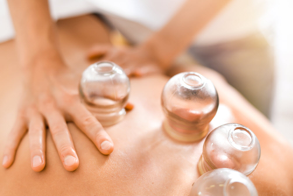 Cupping Therapy