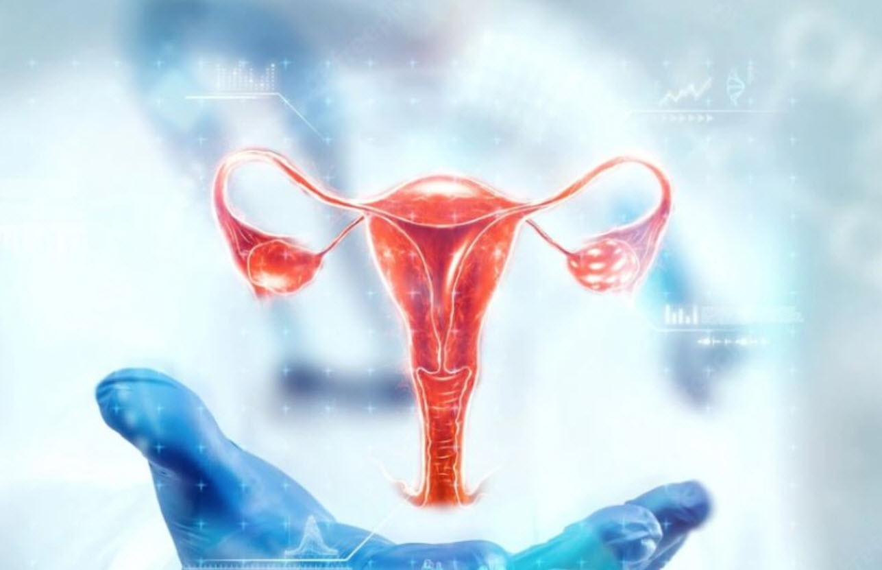 Uterine Fibroids and Endometriosis Contraception