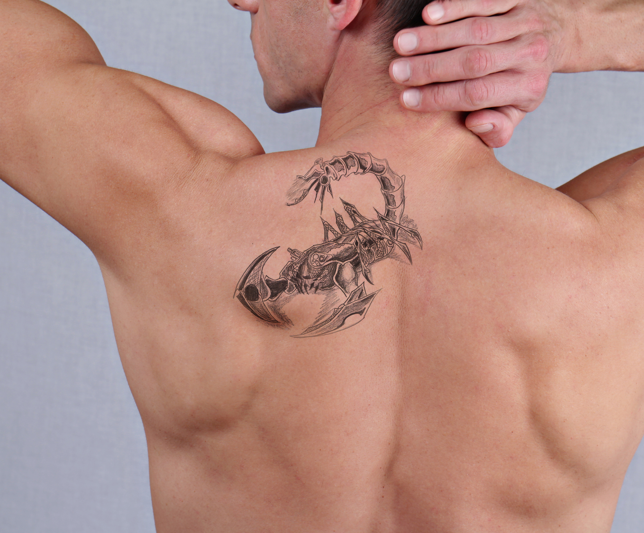 Laser Tattoo Removal