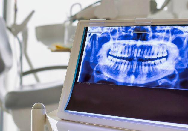 Advanced Dental X-Rays