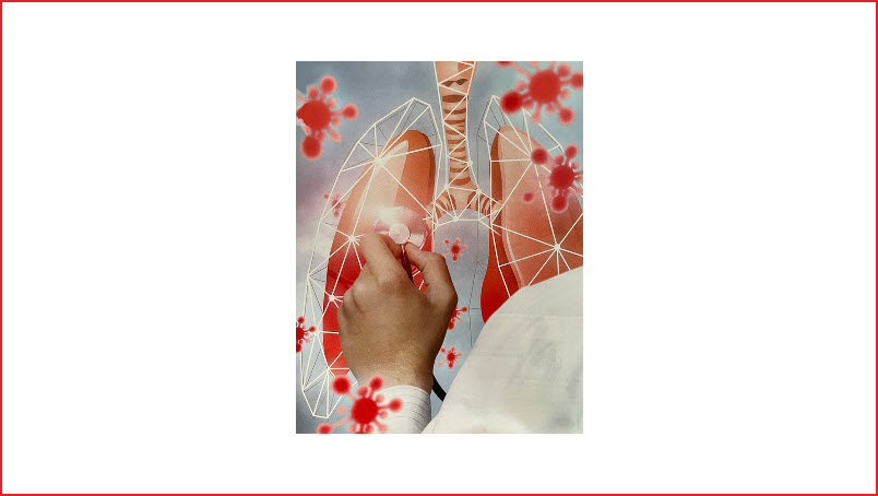 Upper Respiratory Infection